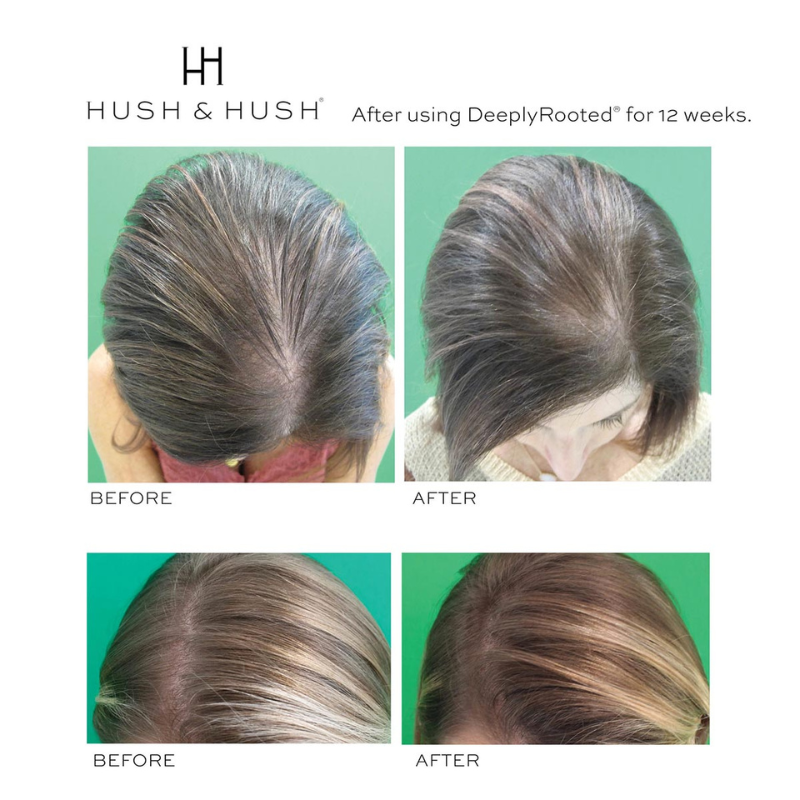HUSH-HUSH-DEEPLYROOTED-8-2_3 Vorher-Nachher-Bilder von Haaren nach 12 Wochen Anwendung von Hush & Hush DeeplyRooted.