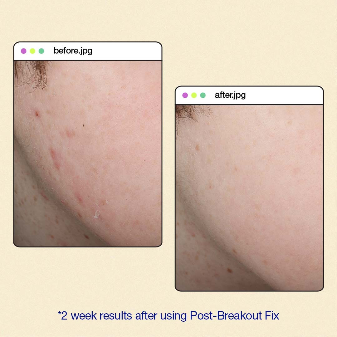 post-breakout-fix-before-after-010